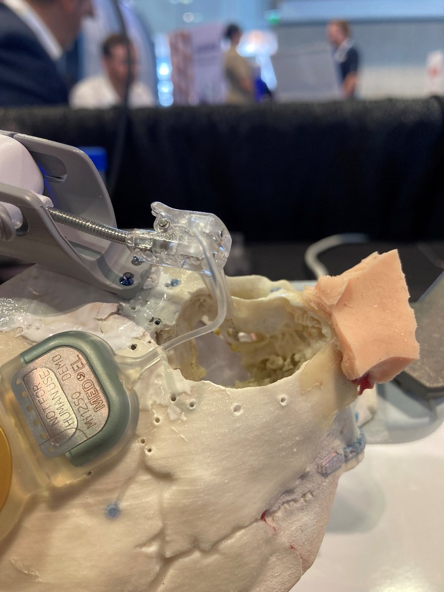 iotaMotion's tweet photo. Don't forget to come by Booth 2308 at the @AAOHNS OTO Experience! #OTOMTG23 #iota #RoboticsInCI https://t.co/H0XwzDmpUB