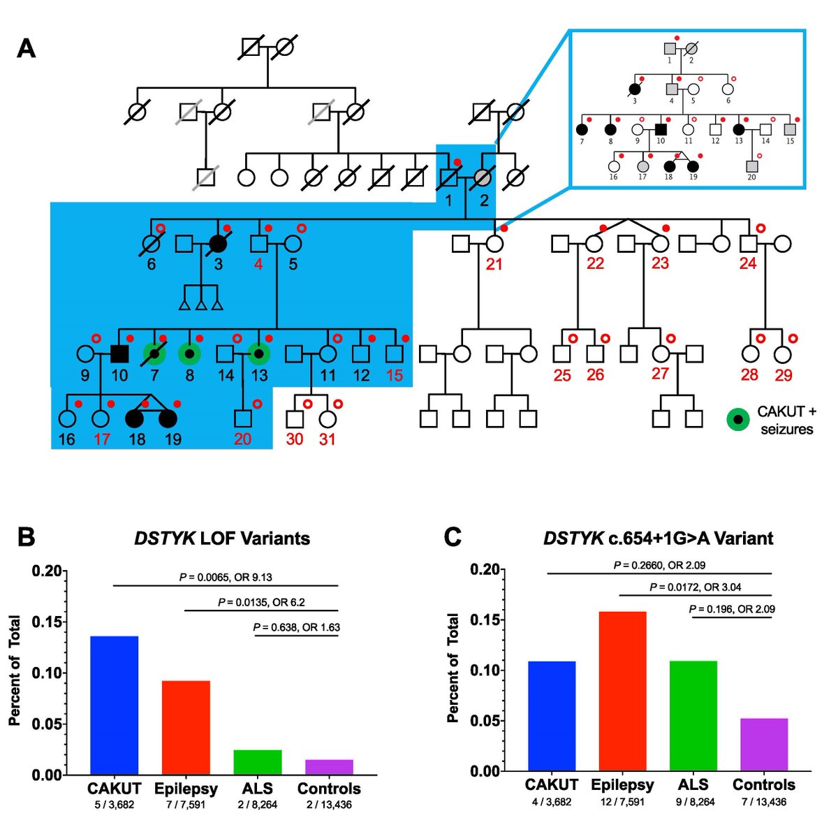 GIMJournal's tweet image. Proceed with caution. #Lossoffunction variants in DSTYK are a risk factor for congenital urinary tract anomalies, but with #lowpenetrance and #variableexpressivity #mousemodels #CAKUT @SannaCherchiLab @JMartinoActual bit.ly/3rz9E3o