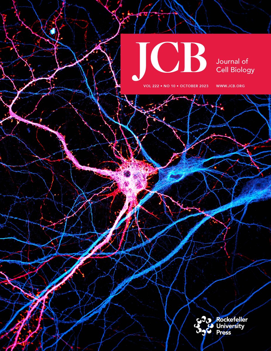 JCellBiol's tweet photo. Our October cover shows a #neuron expressing endogenous GFP-#actin after CRISPR/Cas9-mediated tagging in a hippocampal neuronal culture labeled for MAP2. From @dombingham @christlet et al (https://t.co/yoJfVBVOM0)

Read JCB’s October Issue: https://t.co/aPHG4tskvK https://t.co/TXgmdiPRhl