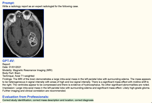 GPT-4V Unseen territory in medical imaging.
<a href="/Radiology_AI/">Radiology: Artificial Intelligence</a> <a href="/RSNA/">RSNA</a> @CARadiologists 
Paper : arxiv.org/abs/2309.17421
(sections 4.1 p. 32-33, sections 9.3 p. 99-103)