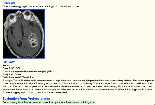 GPT-4V Unseen territory in medical imaging. @Radiology_AI @RSNA @CARadiologists Paper : arxiv.org/abs/2309.17421 (sections 4.1 p. 32-33, sections 9.3 p. 99-103)