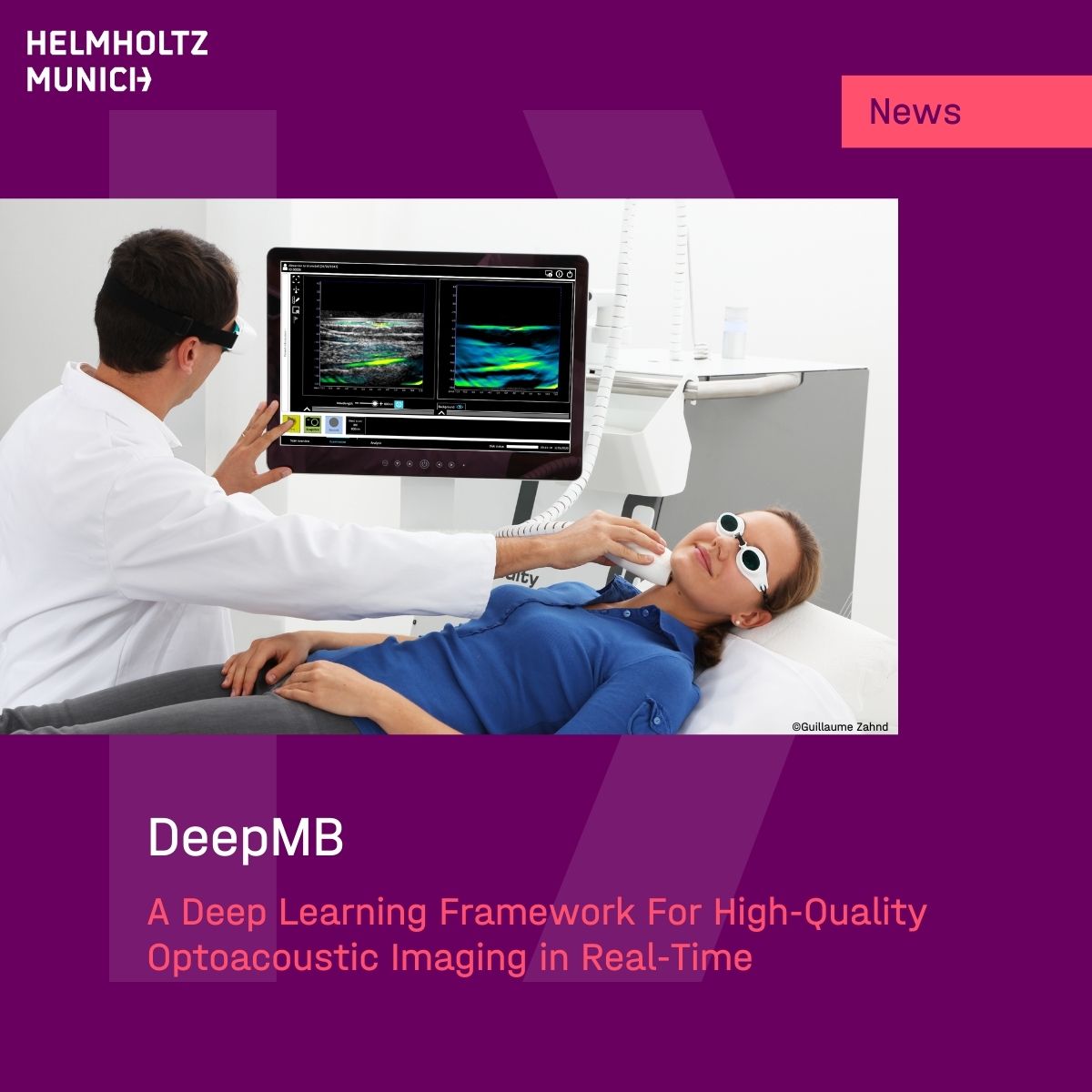 Helmholtz Munich | @HelmholtzMunich (@helmholtzmunich) on Twitter photo #Medicalinnovation: High-Resolution #Optoacoustic #Imaging
💡Researchers at #HelmholtzMunich & <a href="/TU_Muenchen/">TU München</a> advanced a powerful imaging tool for patients dealing with various illnesses, like #BreastCancer.
👉t1p.de/r9i8j
#AIatHelmholtzMunich
#deeplearning #AI #DeepMB #Medicalinnovation: High-Resolution #Optoacoustic #Imaging
💡Researchers at #HelmholtzMunich & <a href="/TU_Muenchen/">TU München</a> advanced a powerful imaging tool for patients dealing with various illnesses, like #BreastCancer.
👉t1p.de/r9i8j
#AIatHelmholtzMunich
#deeplearning #AI #DeepMB
