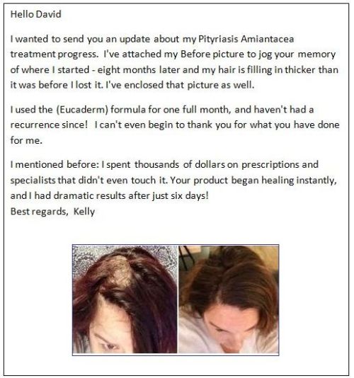DavidSatchell's tweet photo. For those suffering from #PityriasisAmiantacea - please read this from #EucadermHairScalpClinic. And if you know someone who is suffering from this unpleasant disease of the scalp, please show them these articles.  https://t.co/gydo4vzHRi https://t.co/IU0m2ION7D
