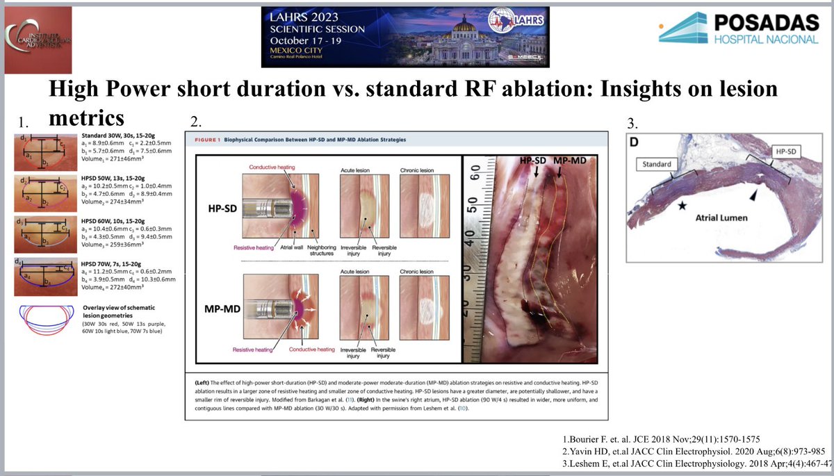 How to avoid AF recurrence in atrial fibrillation? Lesion formation geometry is crucial, resistive vs. conductive heating lesion durability. More to come in @LAHRSonline1 2023. Thanks to @josoriomd for being a great educator and @EladAnter for publishing disrupting science.