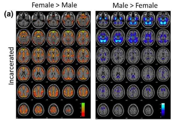 LtAgosta's tweet photo. Os facilito un hilo para citárselo en respuesta a los cenutrios de abajo:

-1300 cerebros estudiados🧠🧠

-93% de acierto al clasificarlos en hombres 👨 y mujeres👩

-Cómo? Tamaños de diferentes áreas del cerebro.

https://t.co/WqkGSjYib9 https://t.co/esWu8JhHGA