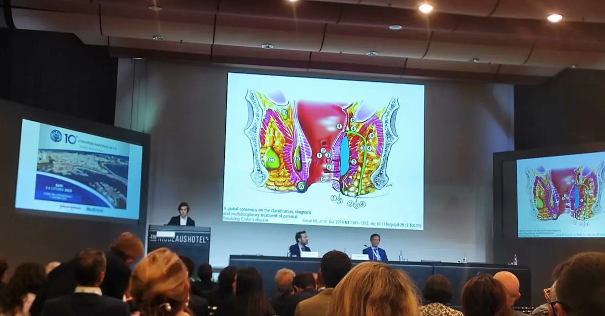 GianlucaPellino's tweet photo. Delighted to present at @YouSICCR #SICCR2023, full house for #IBD

+ good to catch up with friends!

@drfrancescopata @alicefrontali @marina68fiorino  @vittoriabellat0  
@mic_carvello @DrUgoGrossi @Michel_Mineccia @matteorottoli
..and more

@UABBarcelona
@vallhebron
@escp_tweets https://t.co/VhgEzNvryx