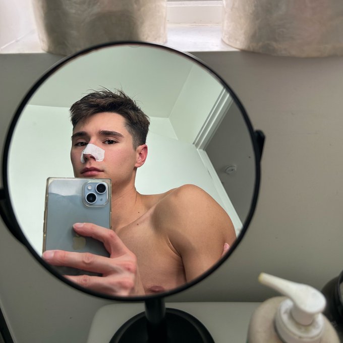 2 pic. He said &ldquo;I love the freckles on your nose&rdquo; and I responded &ldquo;you mean my blackheads?&rdquo; Cut to me