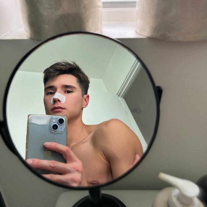 1 pic. He said &ldquo;I love the freckles on your nose&rdquo; and I responded &ldquo;you mean my blackheads?&rdquo; Cut to me