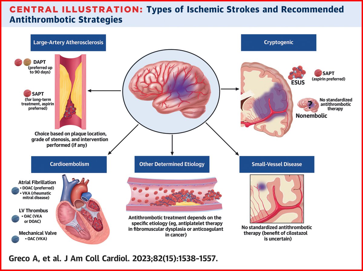 In patients with stroke events, bleeding can pose significant challenges in antithrombotic therapy. We outlined an updated therapeutic algorithm to support physicians in tailoring the strategy to the individual patient and underlying mechanism of stroke. authors.elsevier.com/a/1hs8s2d9GHwW…