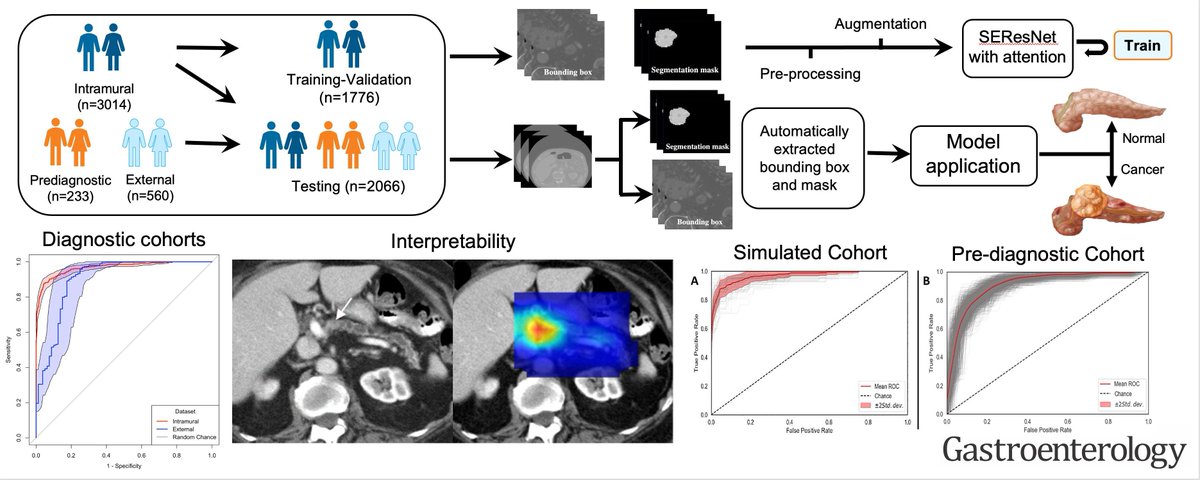 MayoRadiology's tweet photo. @MayoCancerCare researchers used the world's most extensive imaging dataset to build a versatile #AI model that has shown the potential for autonomous detection of #PancreaticCancer on standard #CTimages when surgical intervention can still promise a cure. #SeeingIsSaving https://t.co/RaqpLRRH8m