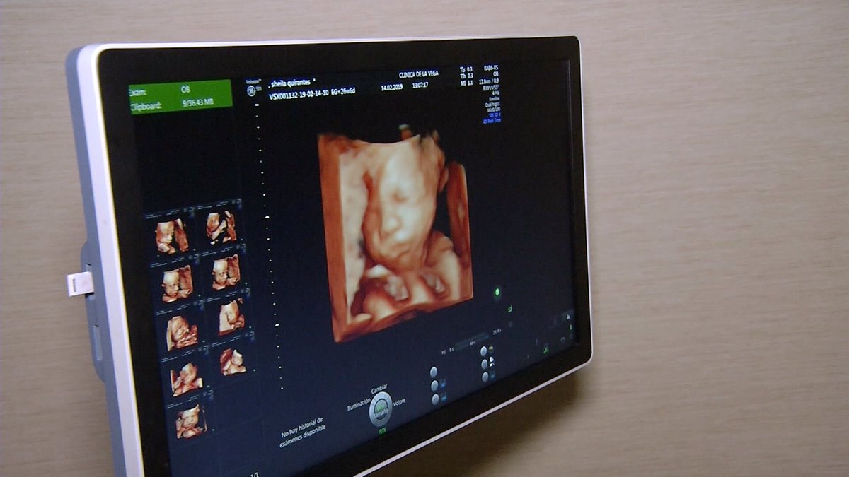 L’Organització Mundial de la Salut ha qualificat la infertilitat com un problema de salut pública global que afecta una de cada 6 parelles

➡️ No s'haurien d'incrementar els recursos públics atenent la magnitut del problema?
#ZoomFertilitat