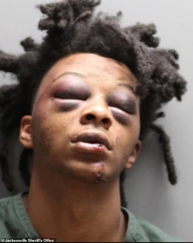 SirMaejorATL's tweet photo. BREAKING NEWS: This is the mugshot of LeKeian Woods, 24,who was left  'unrecognizable' after three white Florida cops beat him severely by kicking and smashing his face into the pavement during a brutal arrest for 'not wearing a seatbelt'

#JacksonvilleSheriffs #JacksonvillePD #JacksonvillePolice #JacksonvilleFlorida #JacksonvilleFL #LekeianWoods #BlackLivesMatter #BLM #SirMaejor