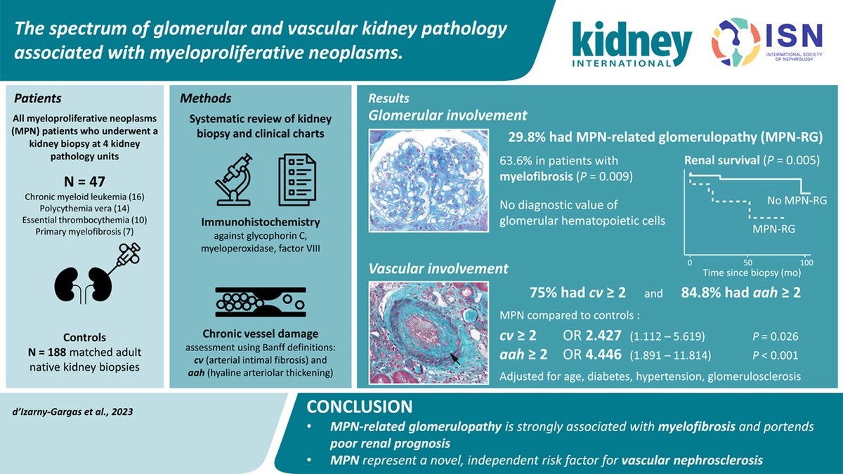 The spectrum of glomerular and vascular #kidney pathology associated with myeloproliferative neoplasms doi.org/10.1016/j.kint… @glomwhisperer @APHP @UP_Medecine #CKD