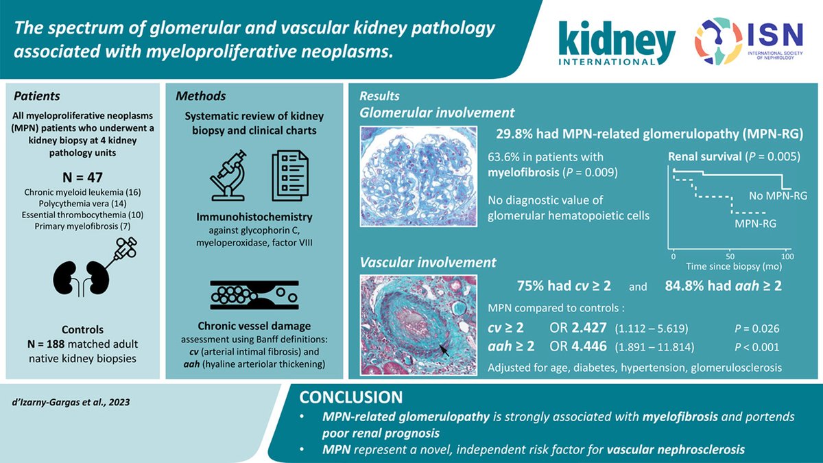Kidney International (@kidney_int) on Twitter photo The spectrum of glomerular and vascular #kidney pathology associated with myeloproliferative neoplasms
doi.org/10.1016/j.kintâŠ
@glomwhisperer <a href="/APHP/">Assistance Publique â HĂŽpitaux de Paris (AP-HP)</a> <a href="/UP_Medecine/">UniversitĂ© Paris CitĂ© MĂ©decine</a>
#CKD The spectrum of glomerular and vascular #kidney pathology associated with myeloproliferative neoplasms
doi.org/10.1016/j.kintâŠ
@glomwhisperer <a href="/APHP/">Assistance Publique â HĂŽpitaux de Paris (AP-HP)</a> <a href="/UP_Medecine/">UniversitĂ© Paris CitĂ© MĂ©decine</a>
#CKD