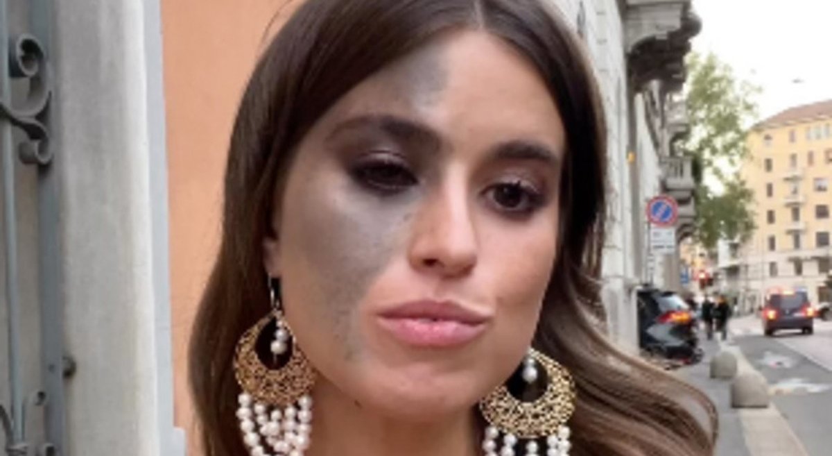 zazoomblog's tweet photo. Carlotta Bertotti la macchia sul viso provocata dal tumore che conquista i social: «La scoperta a 12 anni». Cosè il Nevo di Ota - #Carlotta #Bertotti #macchia https://t.co/n1k5lUUNVV https://t.co/sTuG1r2eb4