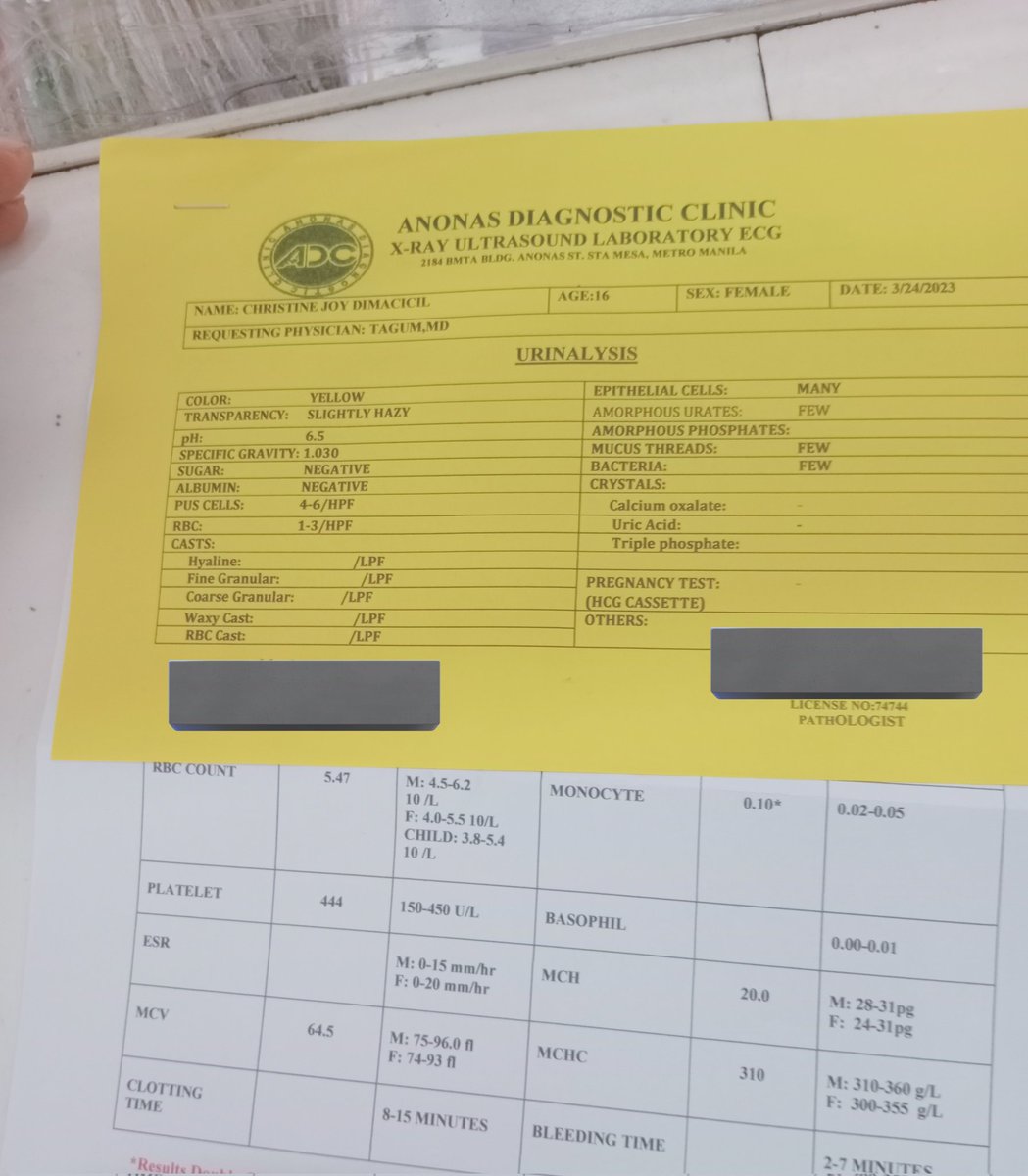 feelskulwithyuu's tweet photo. @mooniebear_kshp buhay ka pa ba ibalik mo na yung 800+ ko mag dadalawang taon na yung order ko wala pa rin sino nakakakilala dito di ako inaaccept sa account niya https://t.co/VXnRhp7omt