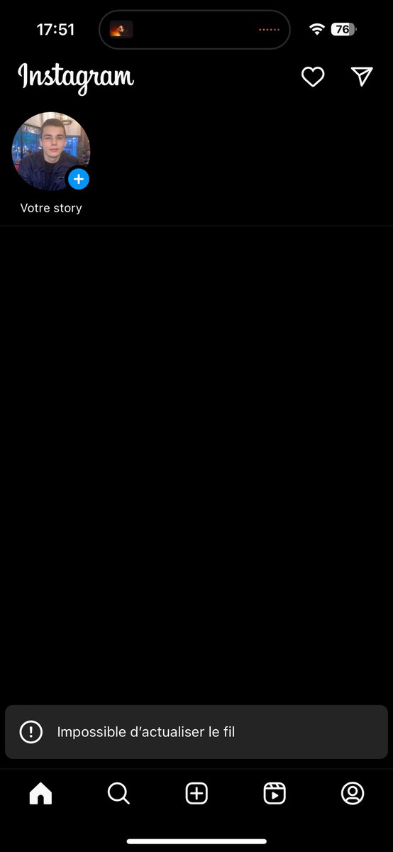 theomdna's tweet image. Depuis +24h je n’ai pas accès à mon insta, ça me fait ces problèmes de page
Pourtant mon profil est tjr visible par les autres quelqu’un peut m’aider svp #instagram #instabug #instagramdown #instadown #instagrambug