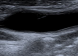 Neurosonology Lab - LHC tweet media