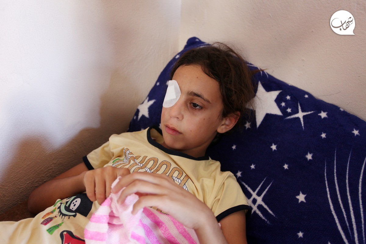 Yusef8A's tweet photo. Remember Areej? The little girl who lost her eye by shrapnel from an occupation missile, The doctors’ final decision was to remove the eye and implant a cosmetic eye, It's an urgent appeal 🙏🇵🇸⤵️
https://t.co/NRGE6Wj3Wt https://t.co/M2UsogDfgt