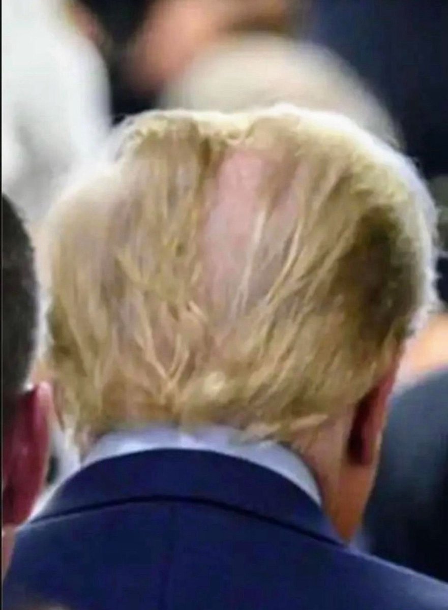 Trump wouldn’t want you to retweet this pic of his bald head.