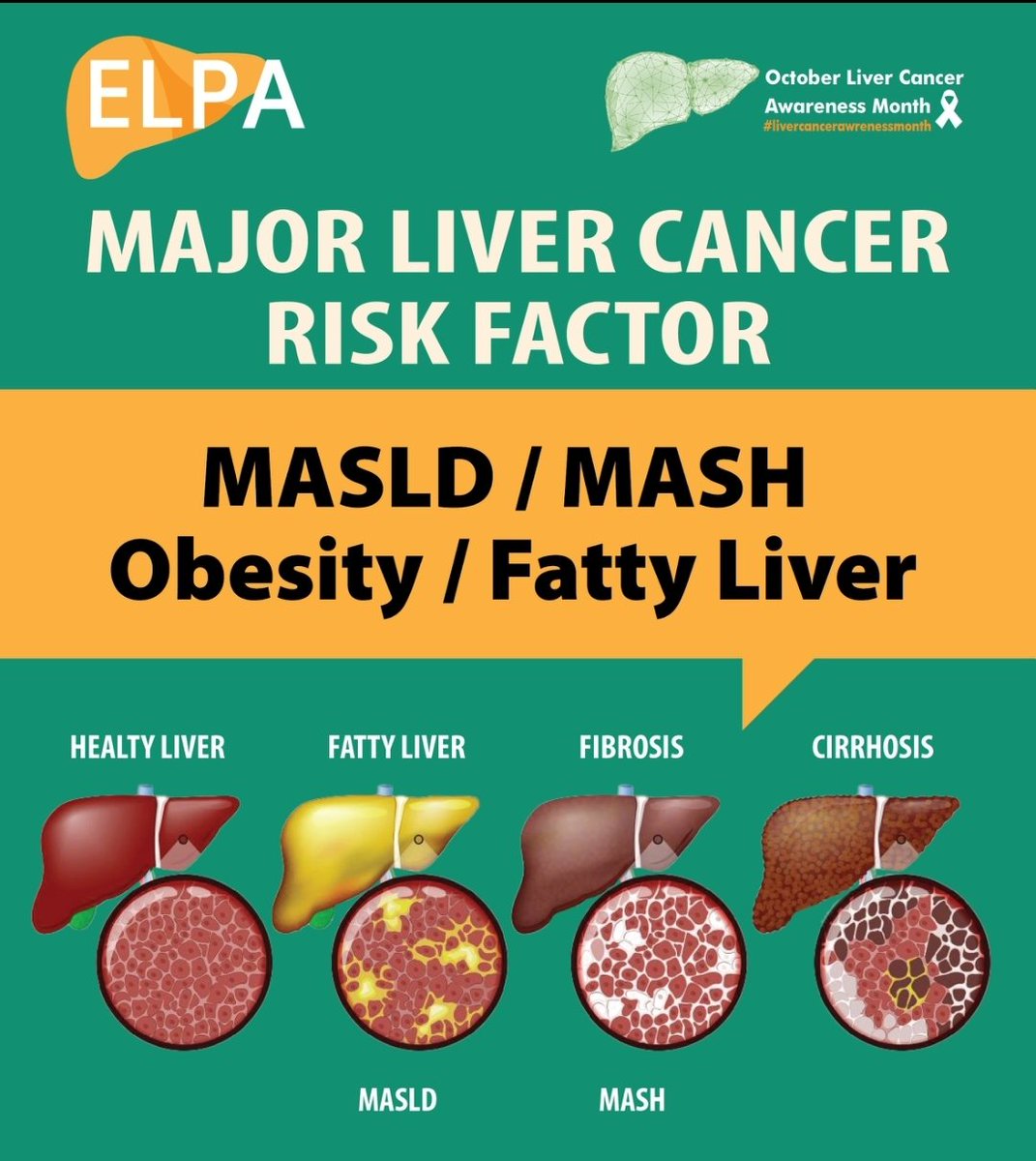🌟 Take Charge of Your Health and Lower #LiverCancer Risk! 🌟 Did you know that nearly 50% of liver cancer cases are preventable? That means YOU have the power to reduce your risk and live a healthier life! 💪#Lifestyle #physicalactivity #LiverCancerAwarenessMonth #EUCancerPlan