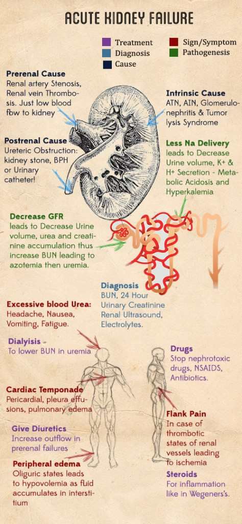 ManualOMedicine's tweet photo. Acute Kidney Injury (AKI) - Summary

#medtwitter #foamed #meded https://t.co/ktSdtJK2MN