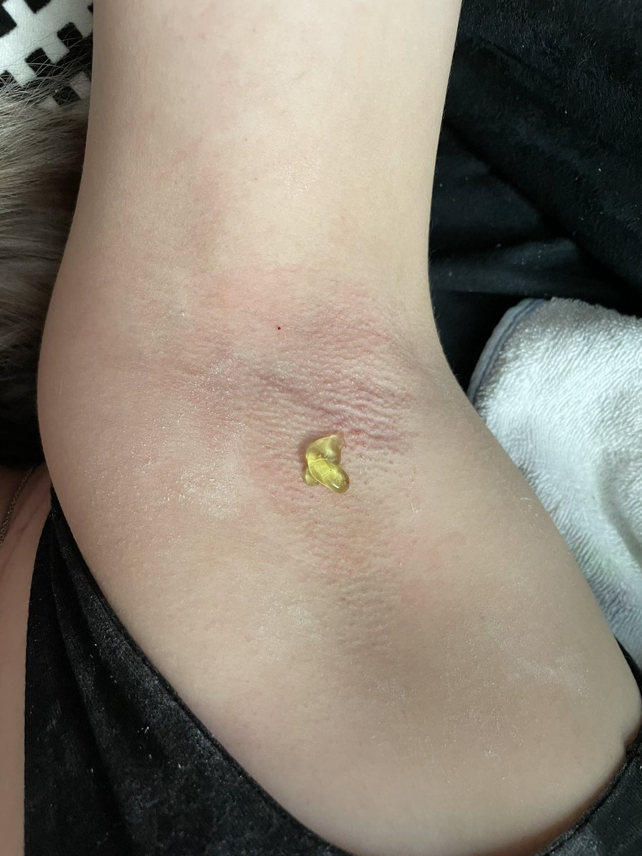 sweetsugarglow's tweet photo. Don’t be spooky 👻 🎃sugar wax your coochie 🕸️🕷️💀 
#Halloween #waxing #spookyvibes

Shop on our tiktok shop to save $$ and get the discounts they offer!!🤑

https://t.co/aDY0nOokZ7 https://t.co/hbL4QUZwJc