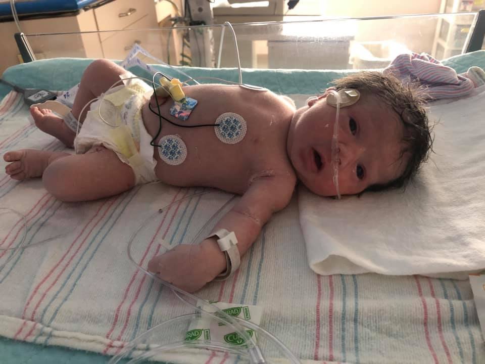 Maisie_Grin2b's tweet photo. On Maisie's 2nd day of life our nurse said it wasnโt normal for her to not be eating so she took her to the NICU to try to get her to eat. Our nurse came back an hour later saying she would be admitting her for several reasons. #grin2b https://t.co/vaBBwcilqh