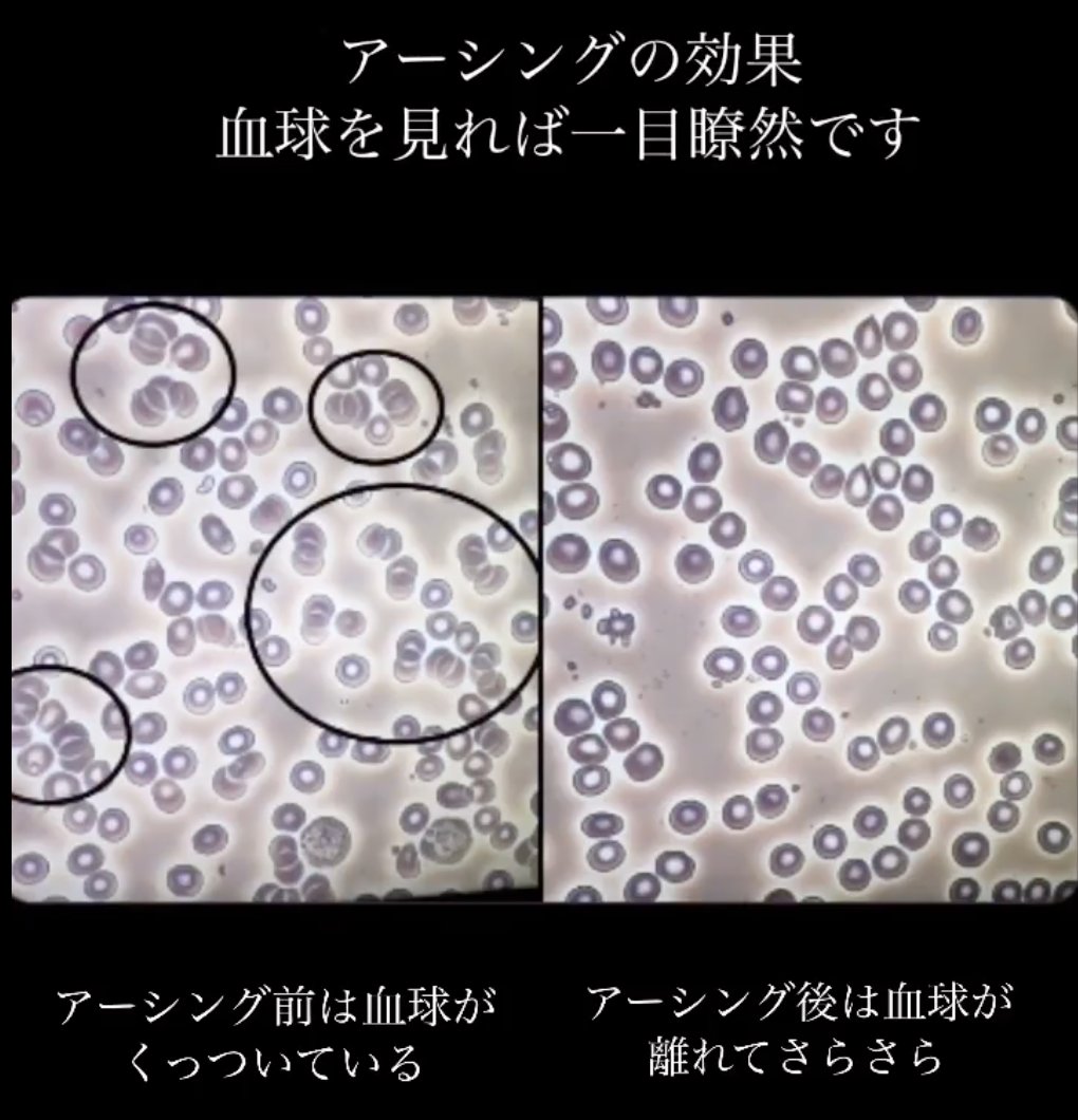裸足の価値に戻ると、やっぱり"アーシング"に触れないわけにいかない。

スピっぽいと評判のアーシングだが真面目に研究されてたりする🤭