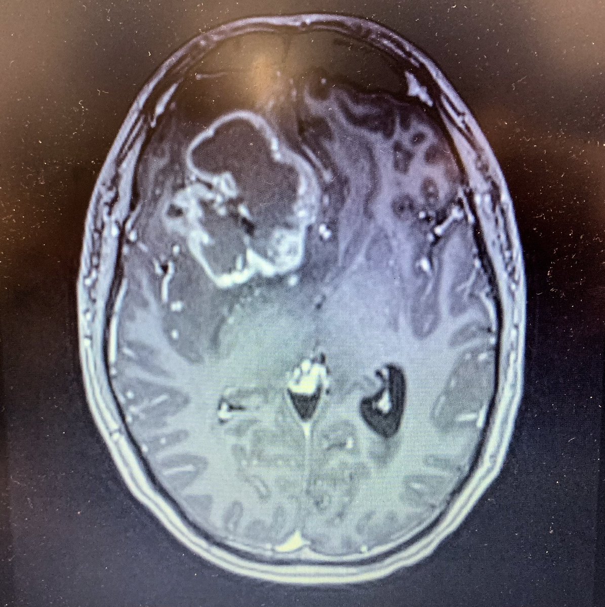 ✏️ 𝕃𝕌𝕂𝔼 tweet media