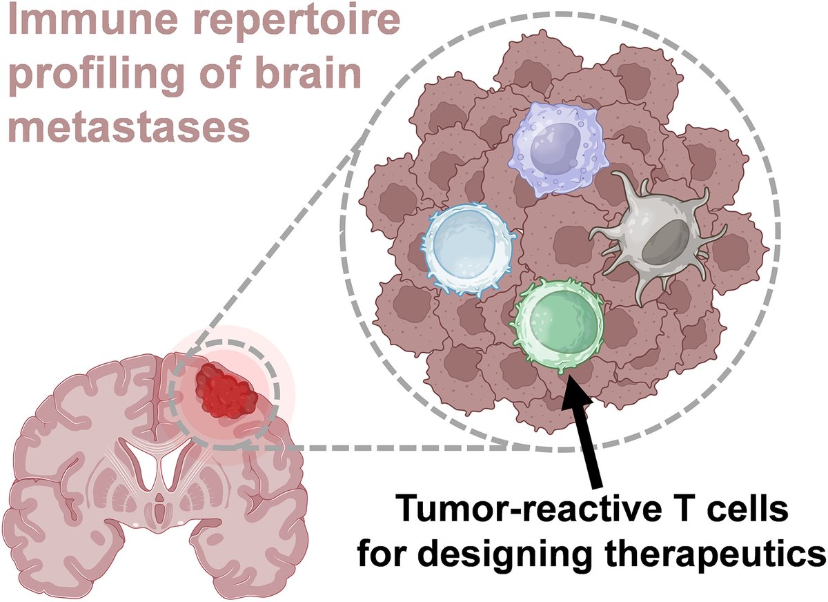 Brain_X_Journal's tweet photo. Understanding the heterogeneous immune repertoire of brain metastases for designing next-gen therapeutics

https://t.co/JJ0WTmVLAI https://t.co/y6RXC8zqKt
