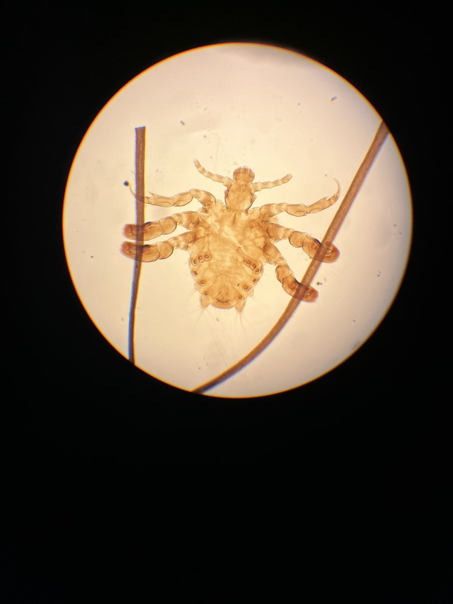 DagnallLab's tweet image. It’s the turn of our TDB and MRes masters students to checkout some creepy crawly ectoparasites this afternoon! Ticks, fleas, mites and lice. #entomology #ectoparasites #scientistsofthefuture