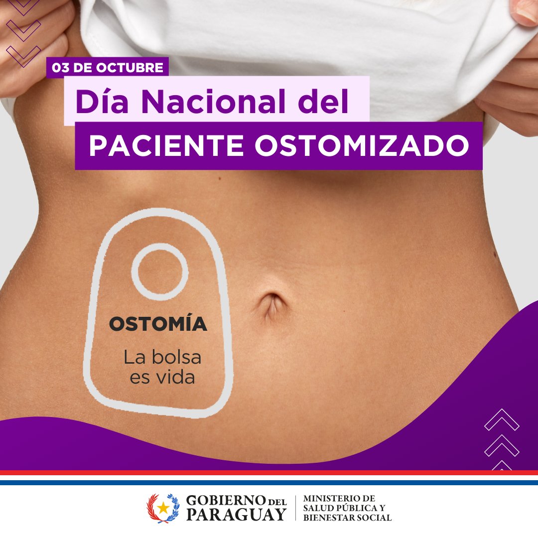 msaludpy's tweet photo. #DíaNacionaldelPacienteOstomizado: “La bolsa es vida”

A la fecha, según registros del Programa Nacional de Atención Integral al Paciente Ostomizado, se ha asistido a 1.500 pacientes, con una cobertura en las 18 regiones sanitarias del país.

➕ℹ️ https://t.co/11hpj62dmm https://t.co/tKrE0dgoSG