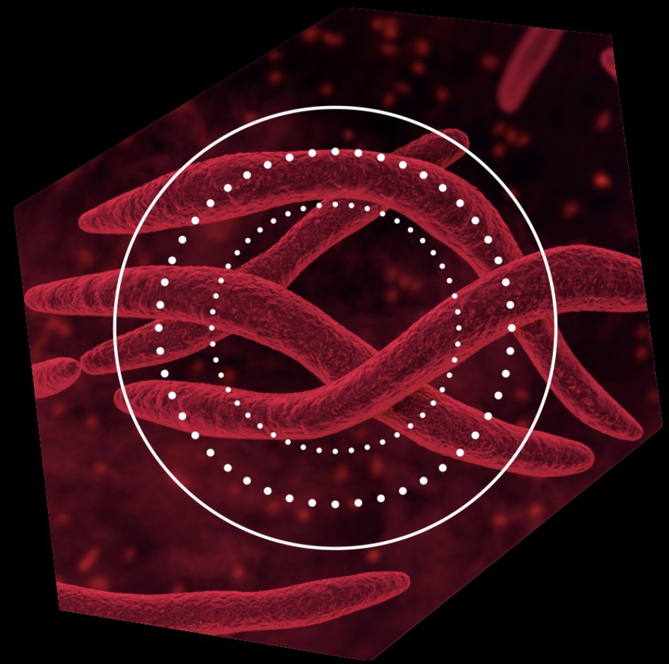 FlightpathB's tweet image. T. denticola and F. Nucleatum are known causal pathogens in periodontal disease but they can also exacerbate systemic inflammation and chronic disease. It&apos;s time to focus on them. Lets get to work!
lnkd.in/gyu-KJe8

#Forsythdentech 2023!
#Oral Health
#Dental health