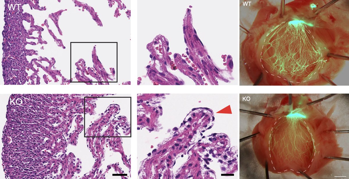 Unexpected non-cell autonomous regulation of cardiac growth and differentiation by transcription factor EBF1. This study took way too long, but @eugkim75 finally got it over the finish line. Now in press at @Dev_journal tinyurl.com/khh9wfrb