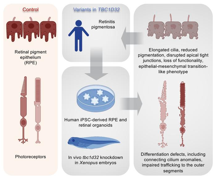 Vision_INM's tweet photo. In collaboration with our colleagues at @NeuroPSI_saclay, @IOB_ch, @Hospital_FJD, @IISlaFe, @CHU_Montpellier and the University Hospital of Parma, we (@INM_Montpellier, @InsermOccMed, @umontpellier) show that TBC1D32 has an important role in retinal #ciliogenesis https://t.co/6yhHOq3RpO