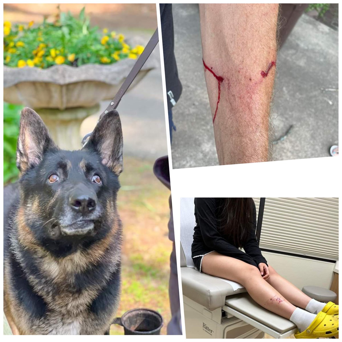 130 dog bite cases are recorded at Aizawl Civil Hospital alone during the month of September 2023. The number of dog bite cases will be much higher in rural Mizoram.
The same hospital also recorded 14 cases of cat bites&amp;1 case of snake bite during the same month. <a href="/ahmaitochhawng/">Ahmai Tochhawng</a>