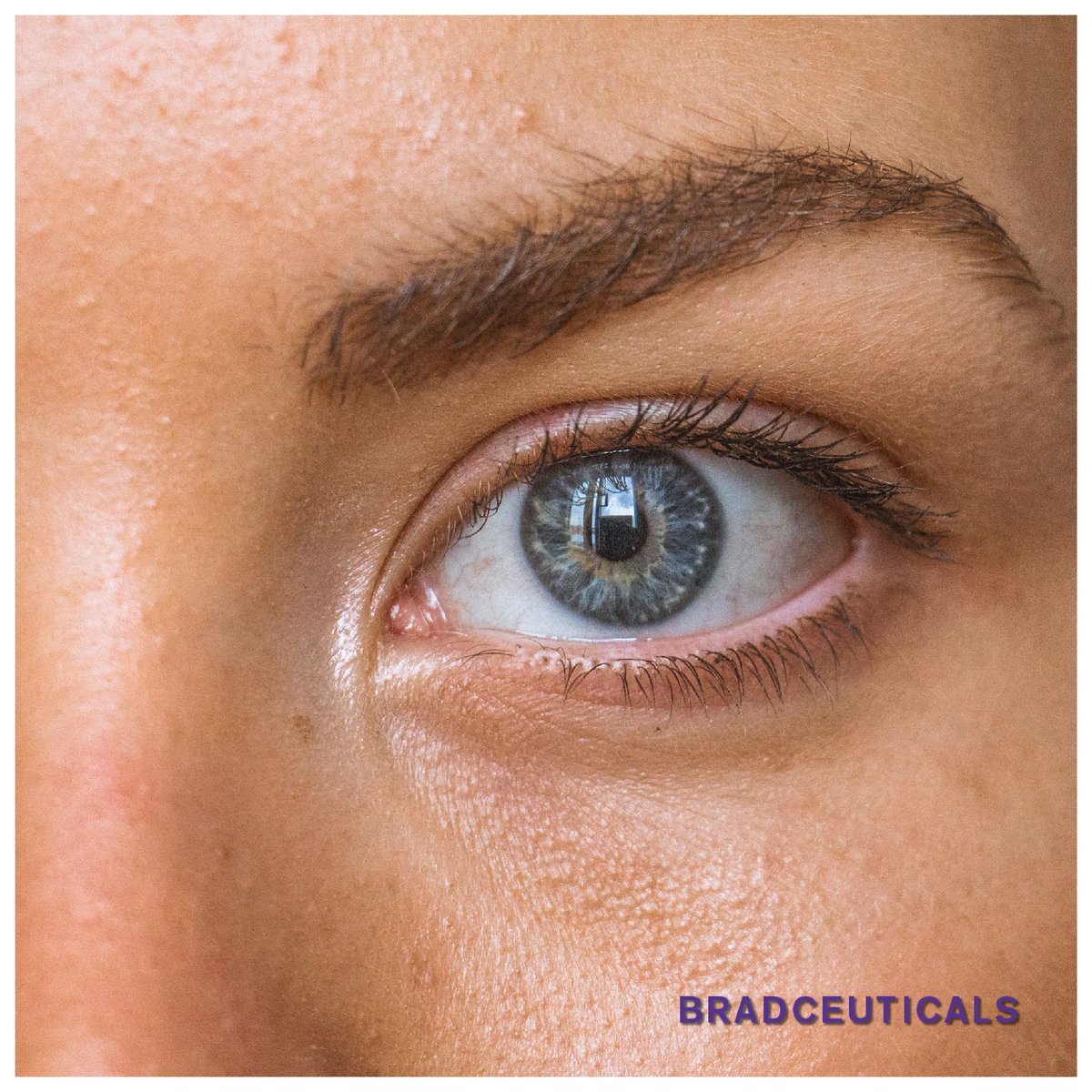 bradceuticals's tweet photo. Introducing our Classic Mesenchymal Stem Cell Serum! Experience the magic of stem cell technology in a bottle. Get yours today: https://t.co/ztHCN8GYh8 #SkinCare #StemCells https://t.co/w9ISEFAeDD