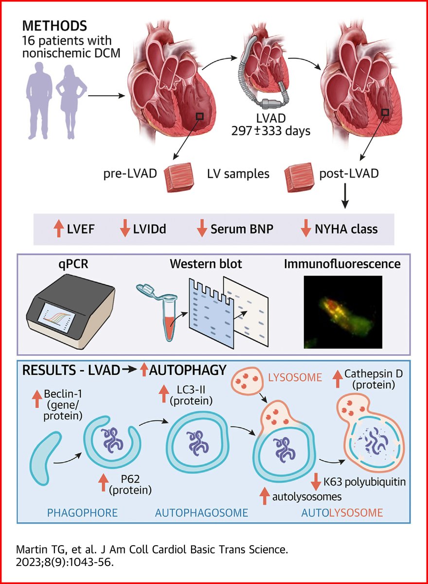 Assessment of LV samples pre- &amp; post-#LVAD therapy reveals that increased autophagy may underlie reverse remodeling seen w/ mechanical unloading. Read the new study by <a href="/Dr_TommyMartin/">Thomas Martin</a>, <a href="/mjuarros99/">Miranda J.</a>, et al: bit.ly/3RHIDFC

#JACCBTS #HeartFailure #CardioTwitter <a href="/CUBoulder/">CU Boulder 🦬</a>