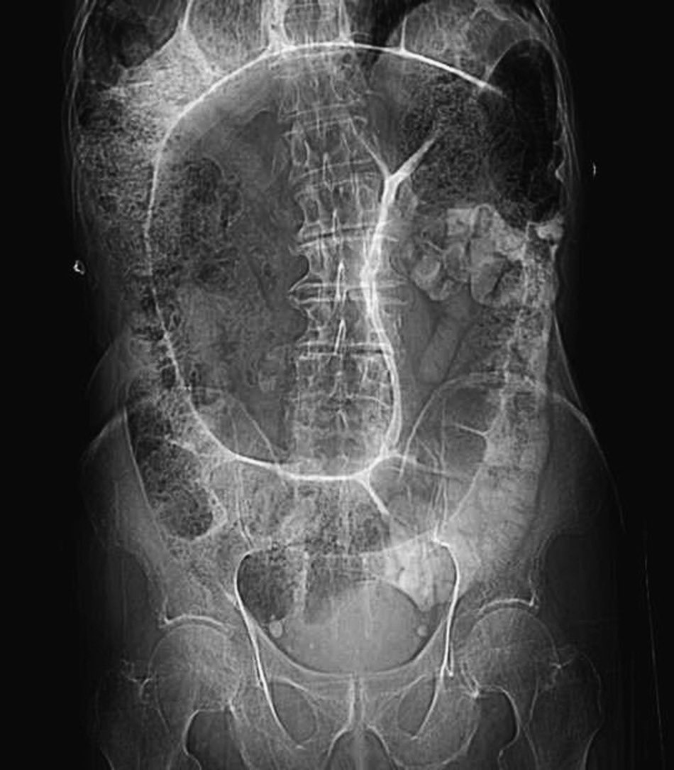 Paul Wischmeyer MD tweet media