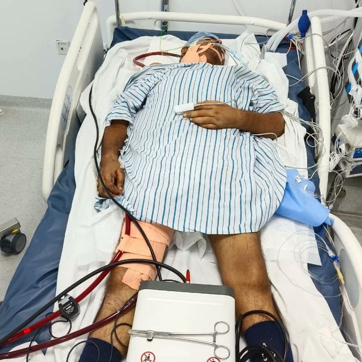 rk561809's tweet photo. अवनीश दुबे का विगत 7/9/2023 से प्रयागराज के हॉस्पिटल और 9/9/23 से 30/9/23 तक लखनऊ के मेदांता हॉस्पिटल में इलाज चला किंतु LUNGS कोलपास होने के कारण अचानक तबियत जादा खराब होने पे 2/10/23 को अपोलो चेन्नई ले जाया गया यह इनके इलाज के लिए( फेफड़ा प्रत्यारोपण )1.5 करोड़ रुपए लगेंगे https://t.co/jkU4sgtbRa