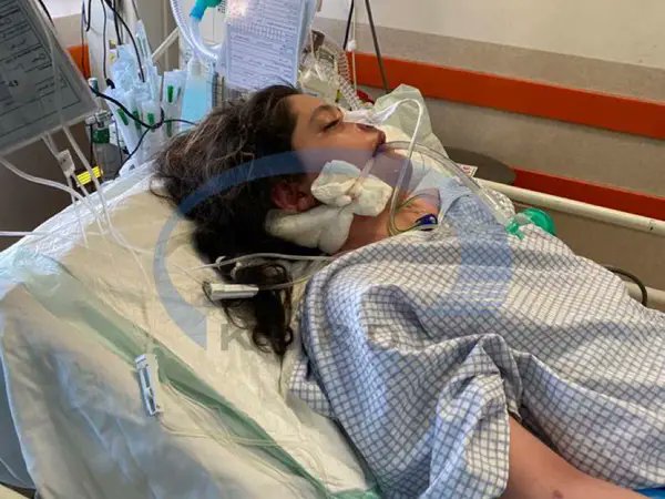 Horrifying images (on left) emerging of #ArmitaGaravand, the 16 year old who is in a coma in #Iran after a reported confrontation with the hijab suppression forces in the Tehran metro. Hauntingly similar to the images of #MahsaAmini (on right) in hospital a year ago.