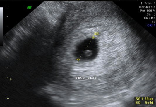 TDibuANL's tweet photo. Primera foto de "Granito de arroz" Martinez Dybala
Somos muy felices !!!! 
#ComingSoon 👶 Mini 🏎️ o Mini ⚽️ https://t.co/EpLpMF8spC
