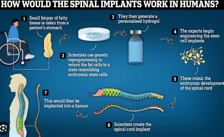 SpinalSavior tweet picture