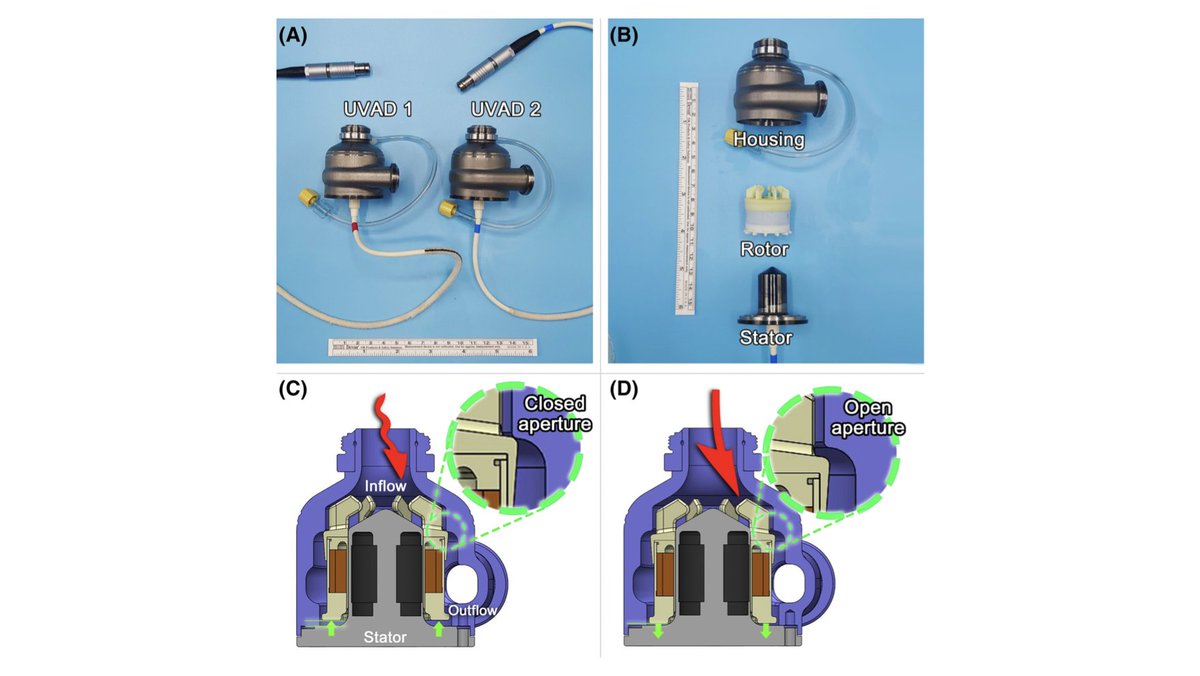 ArtifOrgans's tweet image. Preservation of #Pulsatility with universal #VAD: In vitro assessment for #Biventricular support
👉tinyurl.com/vmhryf9d
@ClevelandClinic @C_Miyagi_MD #BloodPumps #MechanicalCirculatorySupport