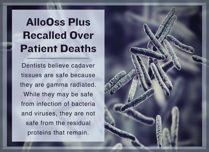 SteinerBio's tweet photo. AlloOss Plus Recalled Over Patient Deaths
Sold by ACE Southern, it is the same product that killed 8 people two years ago due to tuberculosis infection. There has been one death and a number of systemic tuberculosis infections with the same product.
Read: https://t.co/u9KDcgNUrf https://t.co/QOoQe2wbWS