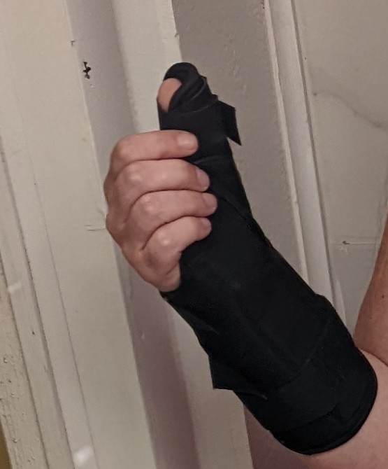 Lanie - hiatus due to injured hand tweet media