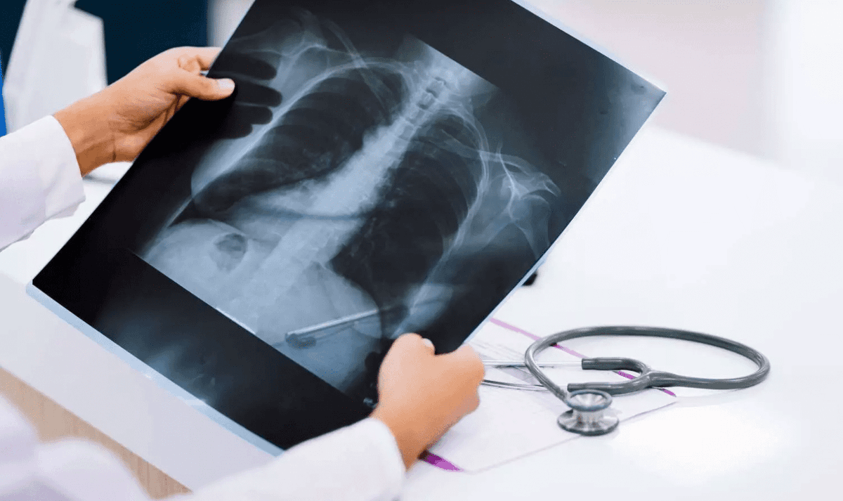MultiplatformAI's tweet photo. The study compared 72 radiologists and AI tools in diagnosing 2,040 chest X-rays of older adults
#AI #airspacedisease #artificialintelligence #chestXrays #complexcases #falsepositives #Healthcare #healthcareintegration #Limitations #llm
https://t.co/x9awJJnmOK https://t.co/One3dC2nQN
