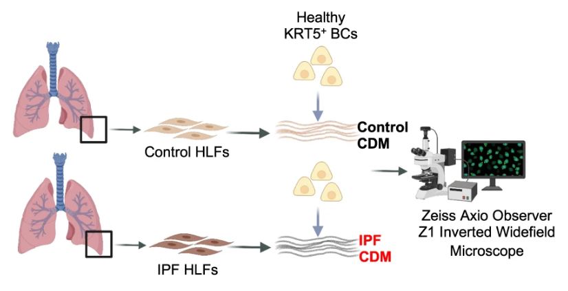 Pulmonary Cell News (@pulmonary_news) on Twitter photo 🔬Researchers at <a href="/imperialcollege/">Imperial College London</a> reveal a potential mechanism by which KRT5+ cells migrate within the #fibrotic lung, navigating regional differences in collagen topography! #PulmonaryFibrosis
👏Congratulations to the team! 🔬Researchers at <a href="/imperialcollege/">Imperial College London</a> reveal a potential mechanism by which KRT5+ cells migrate within the #fibrotic lung, navigating regional differences in collagen topography! #PulmonaryFibrosis
👏Congratulations to the team!