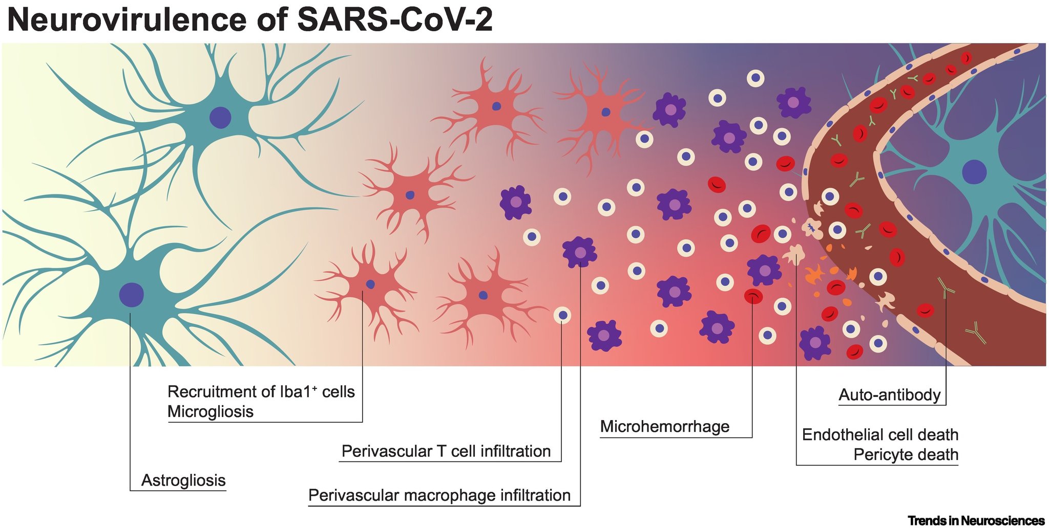 Emmanuel on X: &ldquo;BRAIN and COVID-19 ! 😨 &ldquo;SARS-CoV-2 neurotropism 